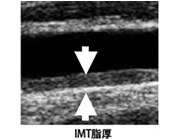 首：頚部エコー IMT脂厚 写真
