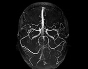 頭部:頭部MRI・MRA 写真02