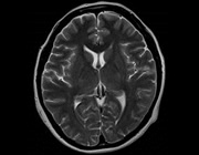 頭部:頭部MRI・MRA 写真03