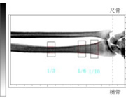 骨:骨密度測定検査 写真03