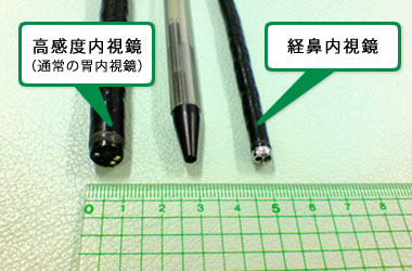 胃内視鏡検査(胃カメラ)写真
