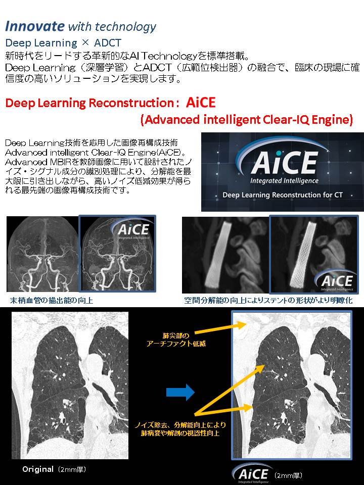 ＣＴ撮影装置更新3.JPG