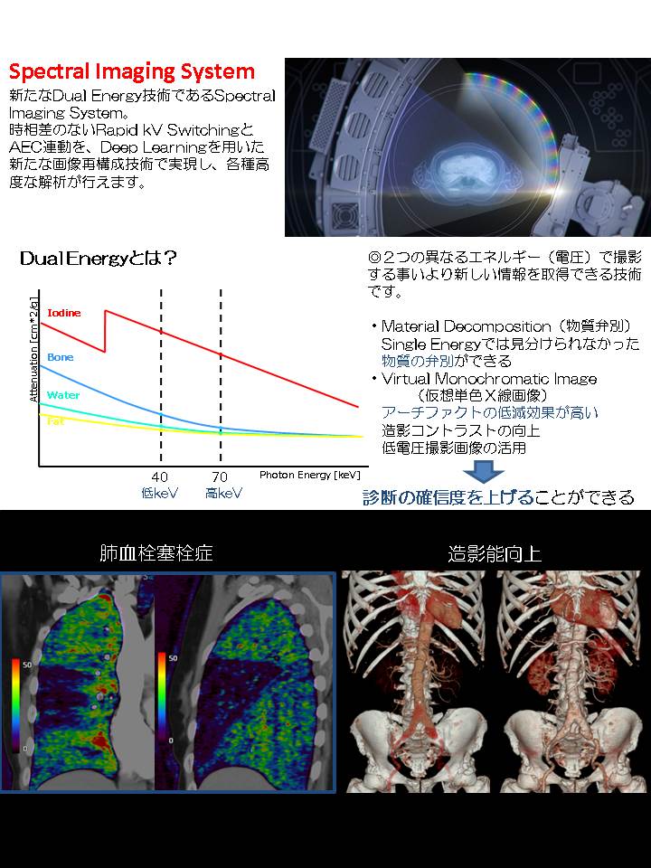 ＣＴ撮影装置更新4.JPG