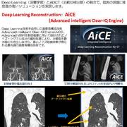 ＣＴ撮影装置更新のお知らせ3