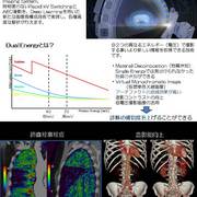 ＣＴ撮影装置更新のお知らせ4