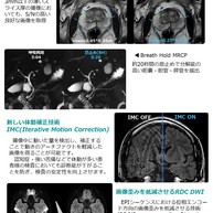 MRI装置更新のお知らせ3