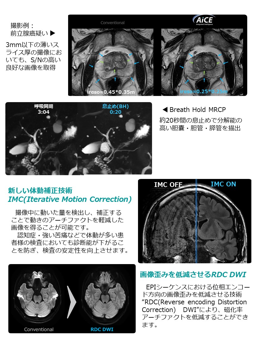 MRI装置更新3.JPG